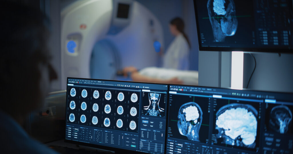 Houston Brain Injury Attorneys